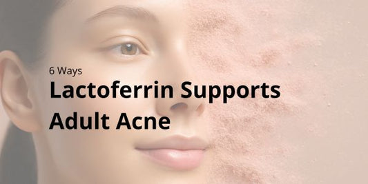 6 Ways Lactoferrin Supports Adult Acne